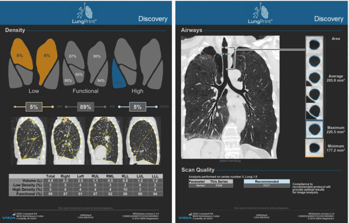 Wp Beyond The Pill Table20 Lungprint Discovery Vida