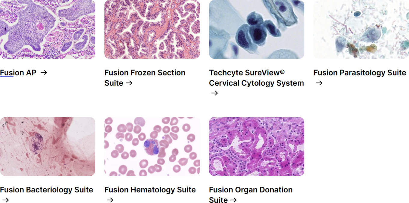 CDISC: The data standard underpinning modern drug development 11 Techcyte Ai Asiisted Solutions